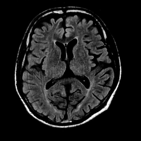 以前の当院のMRI画像 撮像時間3分21秒