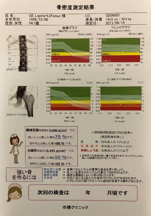 骨密度測定のレポート